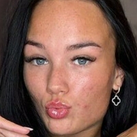 Алексисборедд Голи