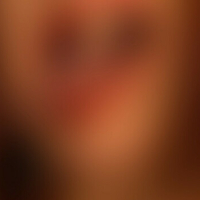 Дайга Корме Голи