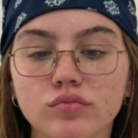 емабруксоксо Голи