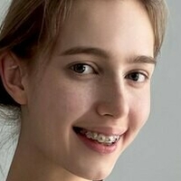 Гайзанайт Голи