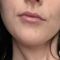 Харли / Блэйррр Голи