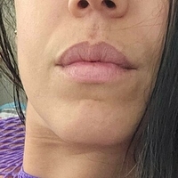 Джозиамазониан10 Голи