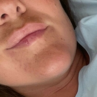 палавата катарина фри Голи