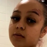 тренчбарби Голи